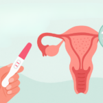 Atipili Endometrial Hiperplazi ve Gebelik Şansı: Fertilite Koruyucu Yaklaşım